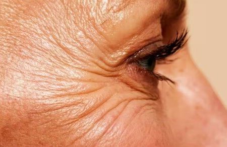 چگونه با افزایش سن از «پروتئین نگهدارنده بدن» مراقبت کنیم؟